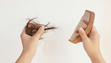 Understanding Hair Transplantation about Techniques, Benefits, and What to Expect